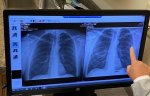 Covid x-ray.jpeg Covid x-ray.jpeg