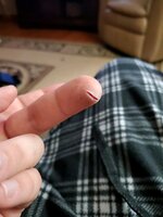 CUT FINGER.jpg