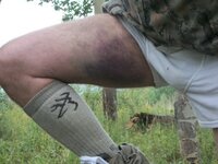 bad leg.jpg