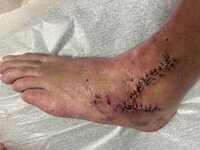 Foot.jpg