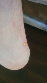 20250914_105818.jpg
